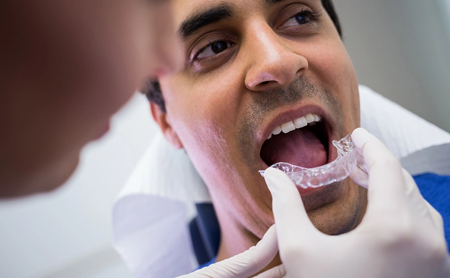 Clear Aligner Therapy