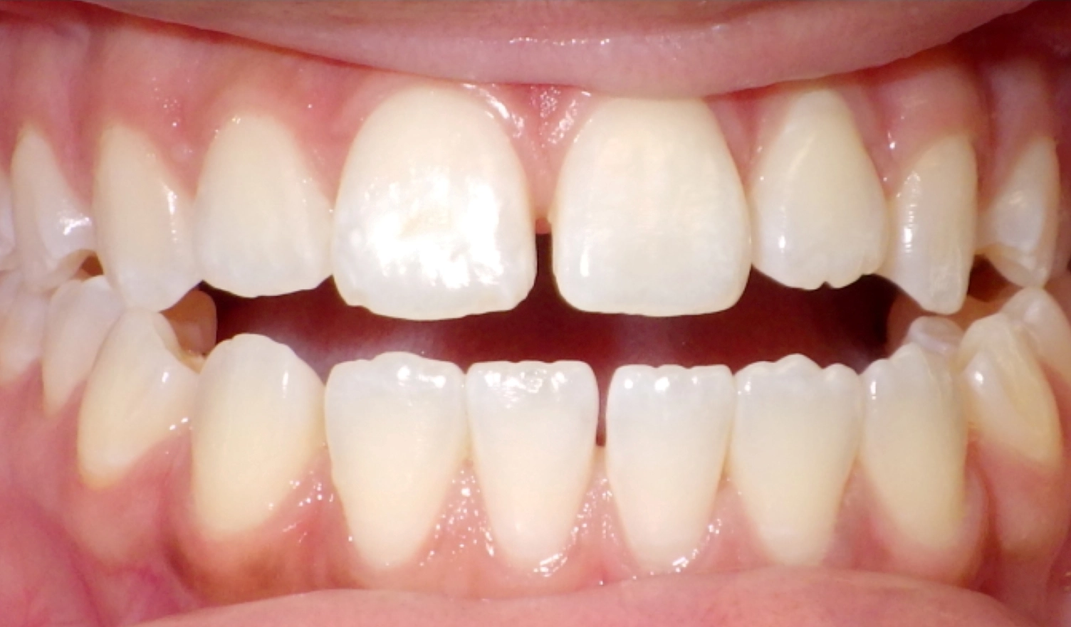 before-img