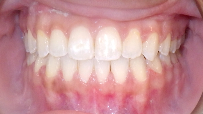 case-1-after