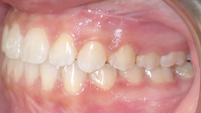 case-2-after