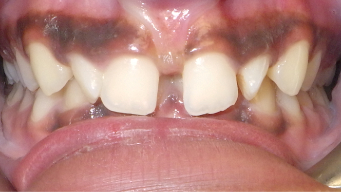 case-3-after