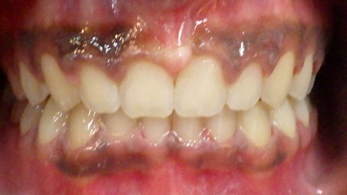 case-3-before