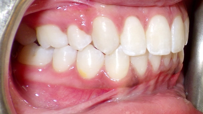 case-5-after