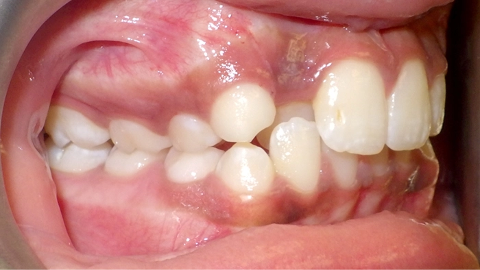 case 5 before