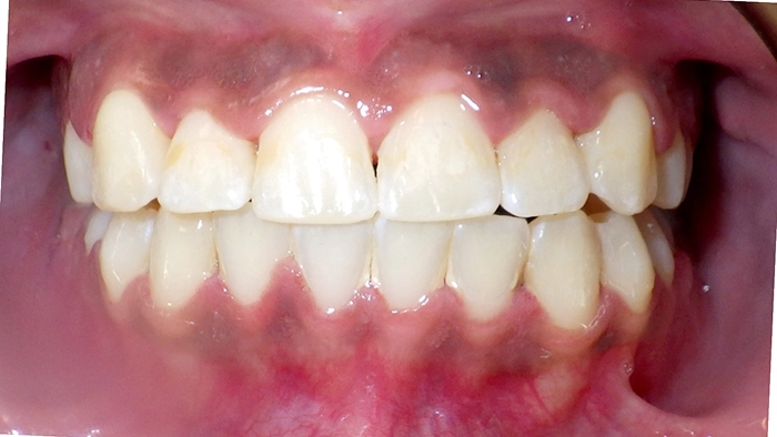 case 6 after