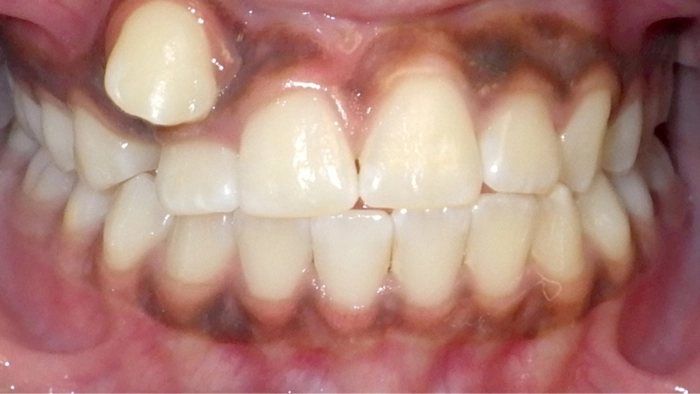 case 6 before