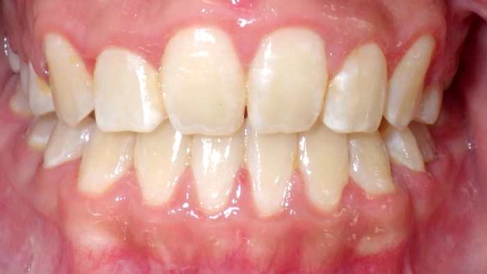 case-7 after