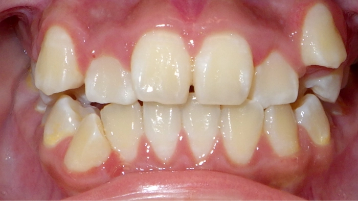 case 7 before
