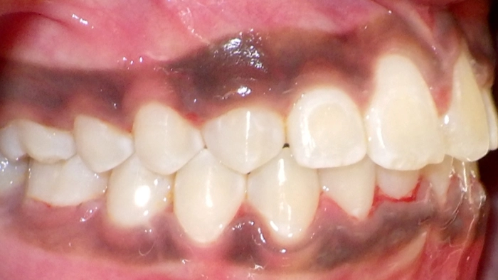 case-8-after