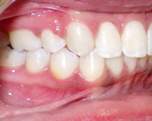 teeth img